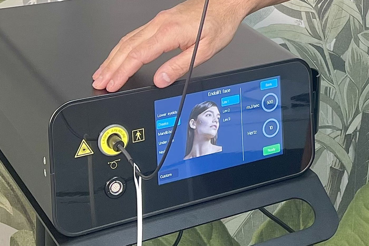 The genuine Eufoton Endolift laser used by Dr Rohit Seth at TK Medispa