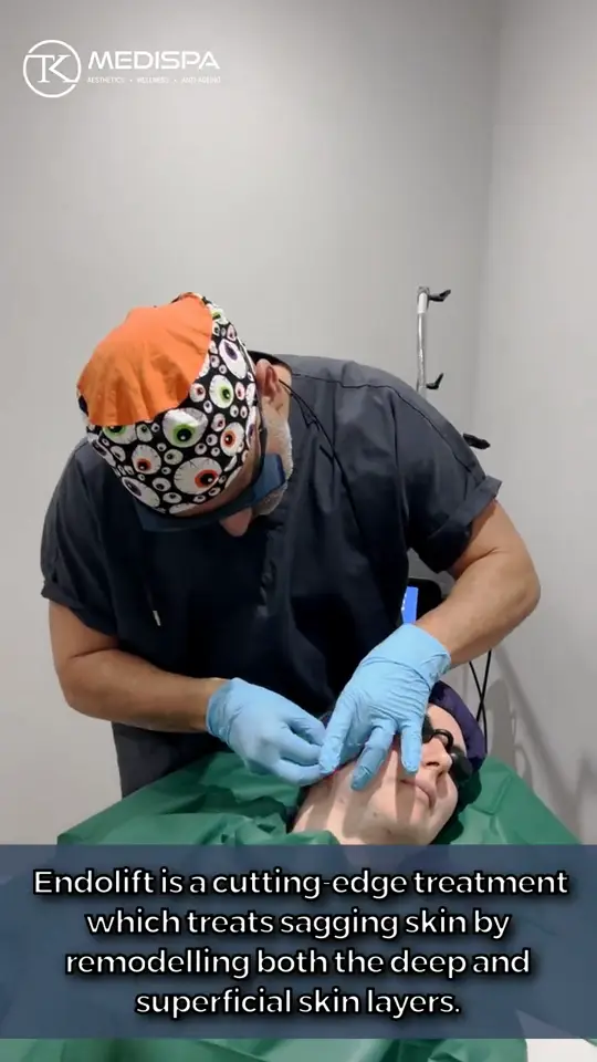 Endolift treatment of the lower face and jawline by Dr Rohit Seth.
