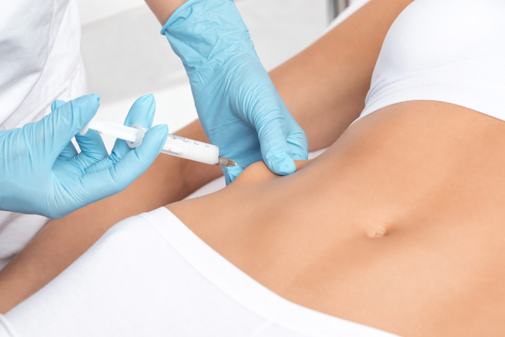 Fat-dissolving injections | A person getting a fat-dissolving product injected into their abdomen area.