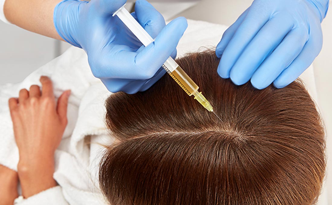 Mesotherapy | An aesthetician treating their client's scalp by injecting the product with a syringe.