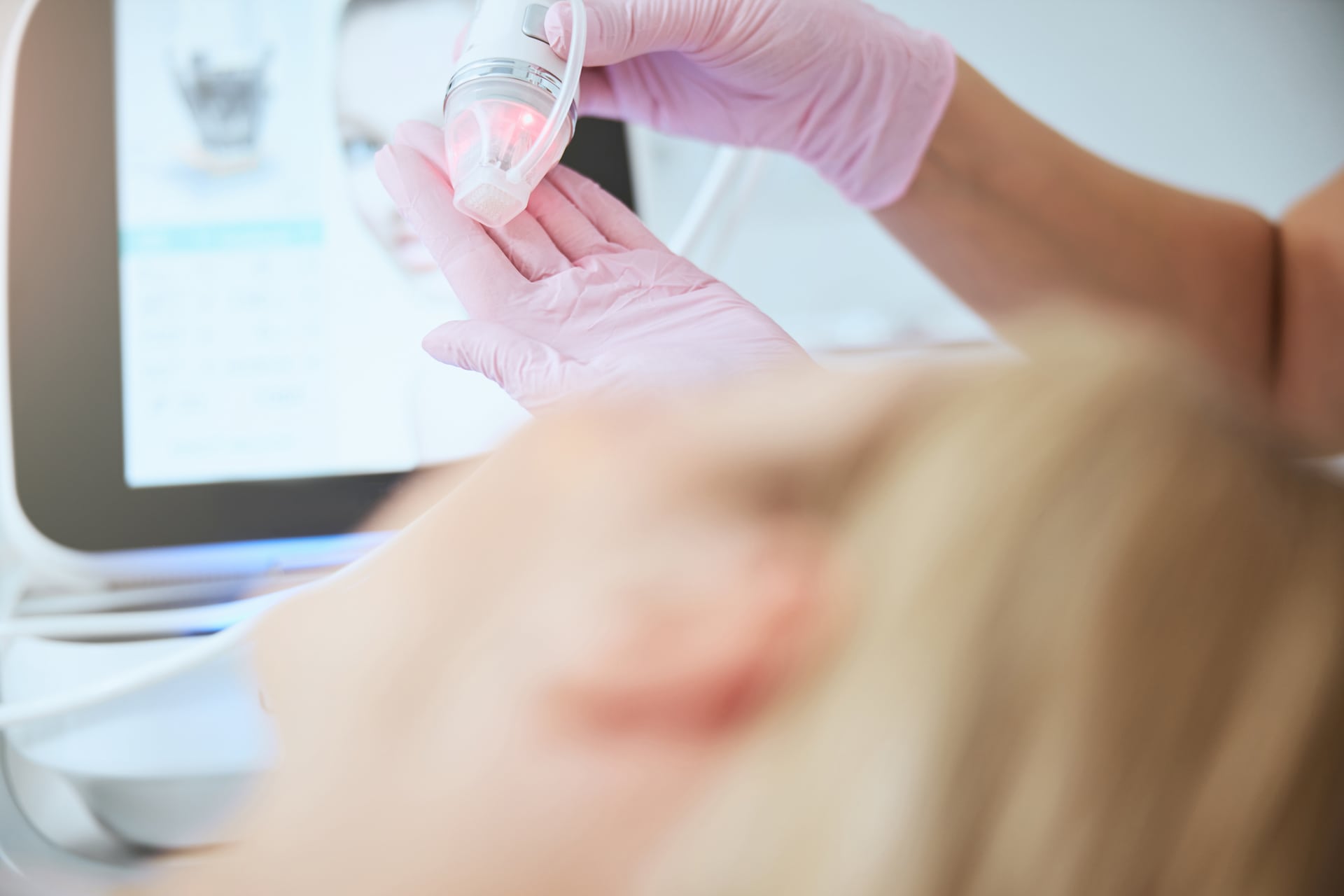 Microneedling | A close-up image of someone applying numbing cream to their hands.